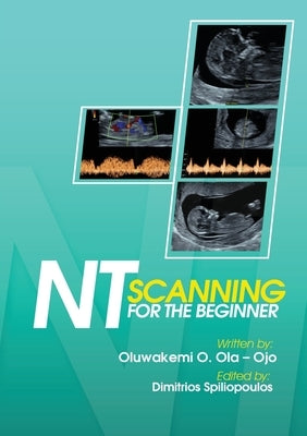 NT Scanning for the Beginner by Ola-Ojo, Oluwakemi O.