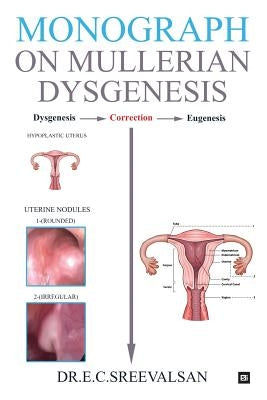 Monograph on Mullerian Dysgenesis by E. C. Sreevalsan