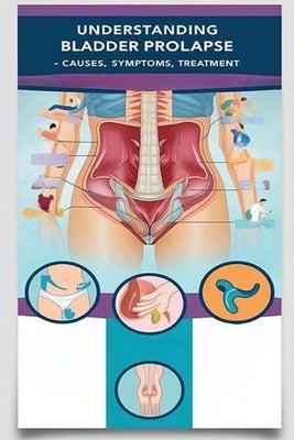 Understanding Bladder Prolapse - Causes, Symptoms, Treatment: Bladder prolapse happens when your bladder pushes through your pelvic floor and into you by Evalina, Recardim Smith