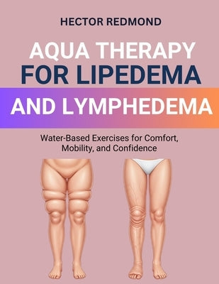 Aqua Therapy for Lipedema and Lymphedema: Water-Based Exercises for Comfort, Mobility, and Confidence by Redmond, Hector