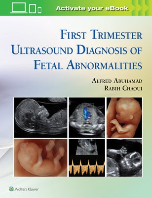 First Trimester Ultrasound Diagnosis of Fetal Abnormalities by Abuhamad, Alfred Z.