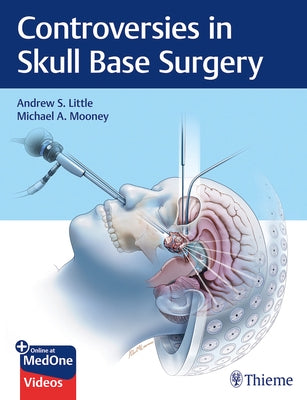 Controversies in Skull Base Surgery by Little, Andrew S.