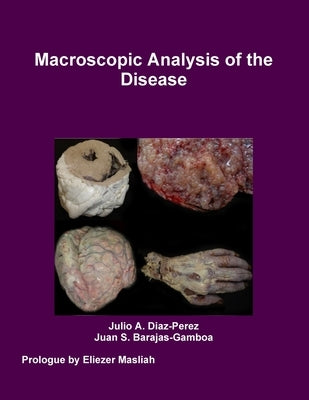 Macroscopic Analysis of the Disease by Diaz-Perez, Julio