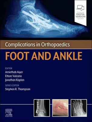 Complications in Orthopaedics: Foot and Ankle by Aiyer, Amiethab