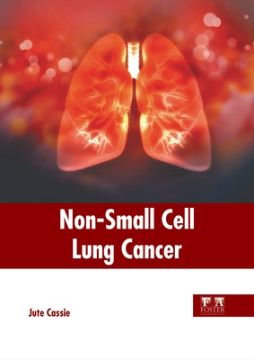 Non-Small Cell Lung Cancer by Cassie, Jute
