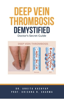 Deep Vein Thrombosis Demystified: Doctor's Secret Guide by Kashyap, Ankita