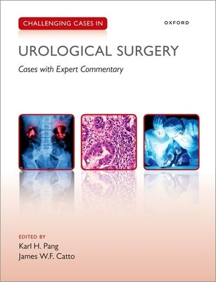 Challenging Cases in Urological Surgery by Pang, Karl