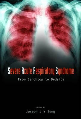 Severe Acute Respiratory Syndrome (Sars): From Benchtop to Bedside by Sung, Joseph Jao Yiu