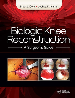 Biologic Knee Reconstruction: A Surgeon's Guide by Cole, Brian