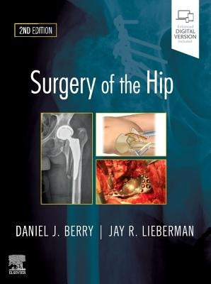 Surgery of the Hip by Berry, Daniel J.