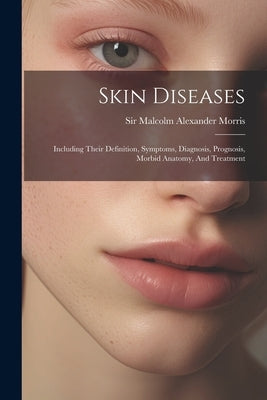 Skin Diseases: Including Their Definition, Symptoms, Diagnosis, Prognosis, Morbid Anatomy, And Treatment by Sir Malcolm Alexander Morris