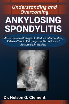 Understanding and Overcoming Ankylosing Spondylitis: Master Proven Strategies to Reduce Inflammation, Relieve Chronic Pain, Improve Flexibility, and R by G. Clement, Nelson