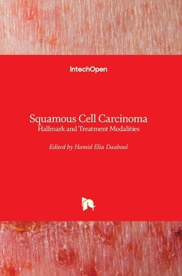 Squamous Cell Carcinoma: Hallmark and Treatment Modalities by Daaboul, Hamid