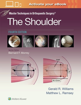 Master Techniques in Orthopaedic Surgery: The Shoulder: Print + eBook with Multimedia by Williams, Gerald R.