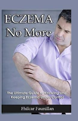 Eczema Cure: Eczema No More - The Ultimate Guide to Knowing and Keeping Eczema Under Control by Faunillan, Fhilcar