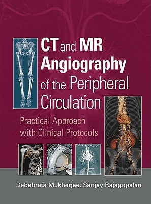 CT and MR Angiography of the Peripheral Circulation: Practical Approach with Clinical Protocols by Mukherjee, Debabrata