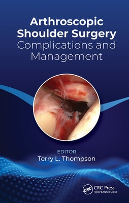 Arthroscopic Shoulder Surgery: Complications and Management by Thompson, Terry