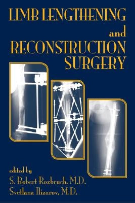Limb Lengthening and Reconstruction Surgery by Rozbruch, S. Robert