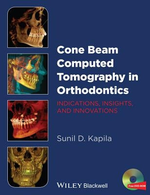 Cone Beam Computed Tomography in Orthodontics: Indications, Insights, and Innovations by Kapila, Sunil D.