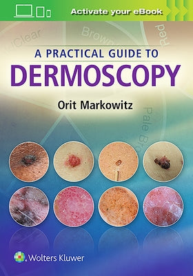 A Practical Guide to Dermoscopy by Markowitz, Orit