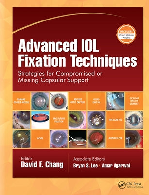 Advanced IOL Fixation Techniques: Strategies for Compromised or Missing Capsular Support by Chang, David F.