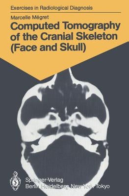 Computed Tomography of the Cranial Skeleton (Face and Skull): 58 Radiological Exercises for Students and Practitioners by Megret, Marcelle