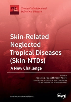 Skin-Related Neglected Tropical Diseases (Skin-NTDs) A New Challenge by Hay, Roderick J.