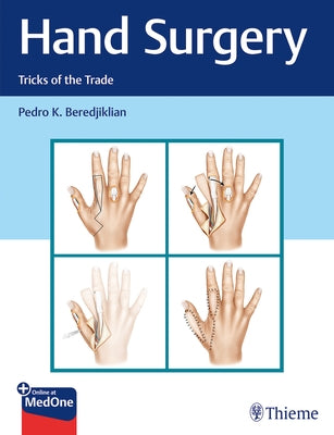 Hand Surgery: Tricks of the Trade by Beredjiklian, Pedro