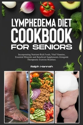 Lymphedema Diet Cookbook for Seniors: Incorporating Nutrient-Rich Foods, Vital Vitamins, Essential Minerals, and Beneficial Supplements Alongside Ther by Hannah, Ralph