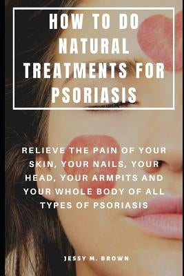 How to Do Natural Treatments for Psoriasis: Relieve the Pain of Your Skin, Your Nails, Your Head, Your Armpits and Your Whole Body of All Types of Pso by Brown, Jessy M.