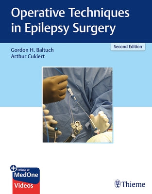 Operative Techniques in Epilepsy Surgery by Baltuch, Gordon H.