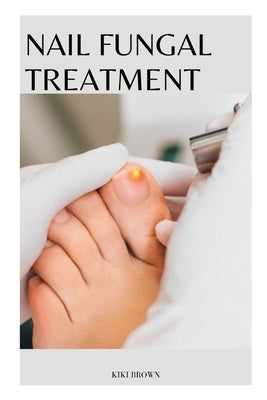 Nail Fungal Treatment: The Scientific Guide to Nail Fungus Treatment by Brown, Kiki