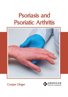 Psoriasis and Psoriatic Arthritis by Ginger, Cooper