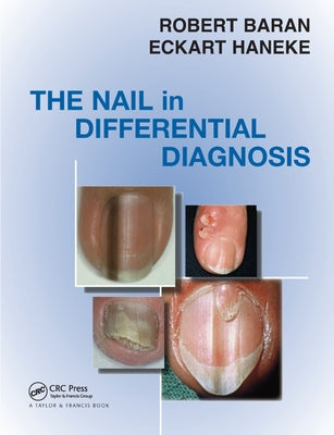 The Nail in Differential Diagnosis by Baran, Robert