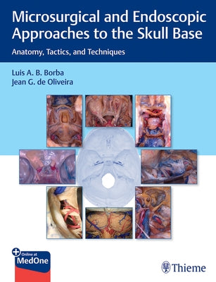 Microsurgical and Endoscopic Approaches to the Skull Base: Anatomy, Tactics, and Techniques by Borba, Luis