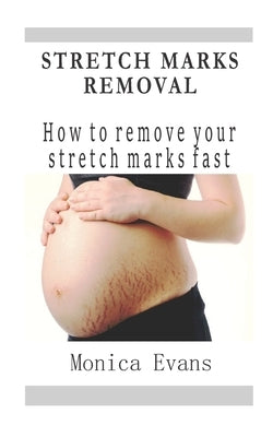 Stretch Marks Removal: How to remove your stretch marks fast by Evans, Monica