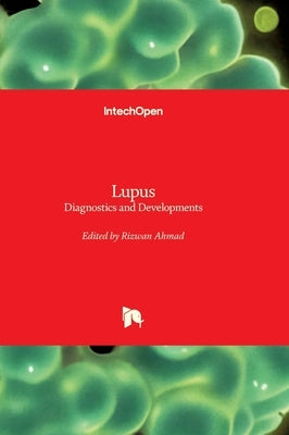 Lupus - Diagnostics and Developments: Diagnostics and Developments by Ahmad, Rizwan