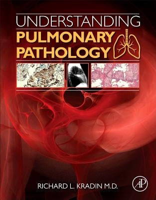 Understanding Pulmonary Pathology: Applying Pathological Findings in Therapeutic Decision Making by Kradin, Richard L.