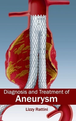 Diagnosis and Treatment of Aneurysm by Rattini, Lizzy