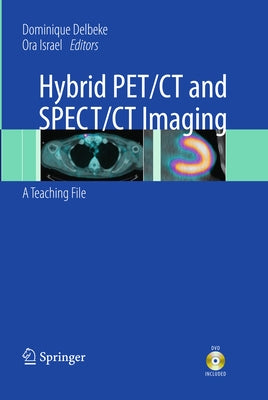 Hybrid Pet/CT and Spect/CT Imaging: A Teaching File by Delbeke, Dominique