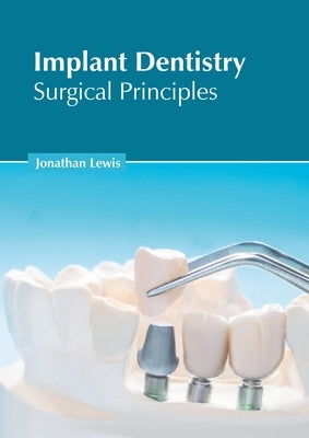 Implant Dentistry: Surgical Principles by Lewis, Jonathan