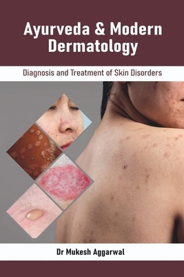 Ayurveda & Modern Dermatology: Diagnosis and Treatment of Skin Disorders by Dr Mukesh Aggarwal
