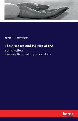 The diseases and injuries of the conjunctiva: Especially the so-called granulated lids by Thompson, John H.