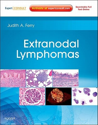 Extranodal Lymphomas: Expert Consult - Online and Print by Ferry, Judith A.