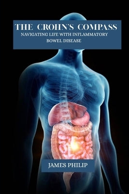 The crohn's compass: Navigating life with inflammatory bowel disease by Philip, James