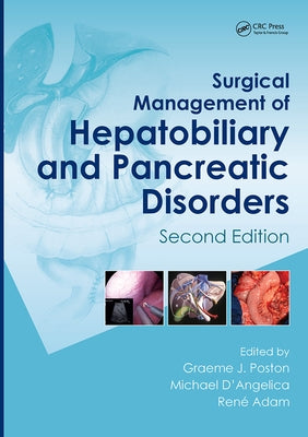 Surgical Management of Hepatobiliary and Pancreatic Disorders, Second Edition by Poston, Graeme J.