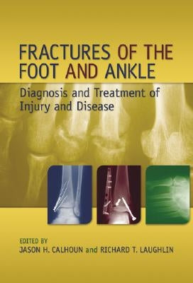 Fractures of the Foot and Ankle: Diagnosis and Treatment of Injury and Disease by Calhoun, Jason H.