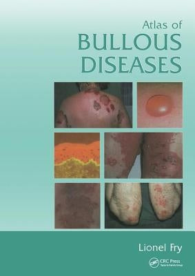 Atlas of Bullous Diseases by Fry, Lionel