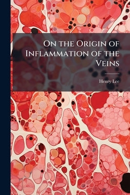 On the Origin of Inflammation of the Veins by Lee, Henry