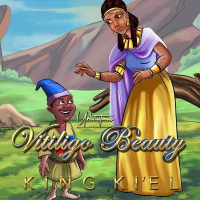Vitiligo Beauty: A Retelling of Snow White by Urbantoons